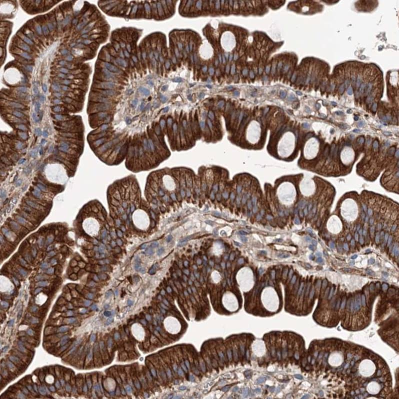 Staining of human small intestine shows strong cytoplasmic and membranous positivity in glandular cells.