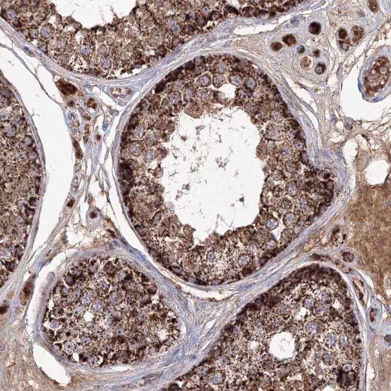 Staining of human testis shows strong granular cytoplasmic positivity in cells in seminiferous ducts.