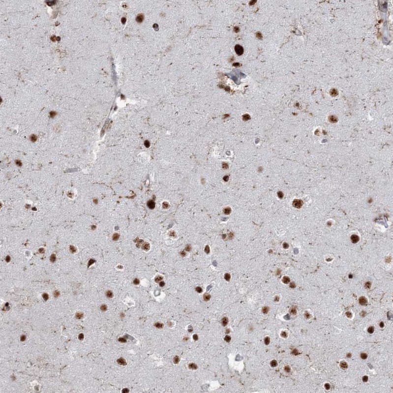 Immunohistochemistry-Paraffin DDX46 Antibody - BSA Free