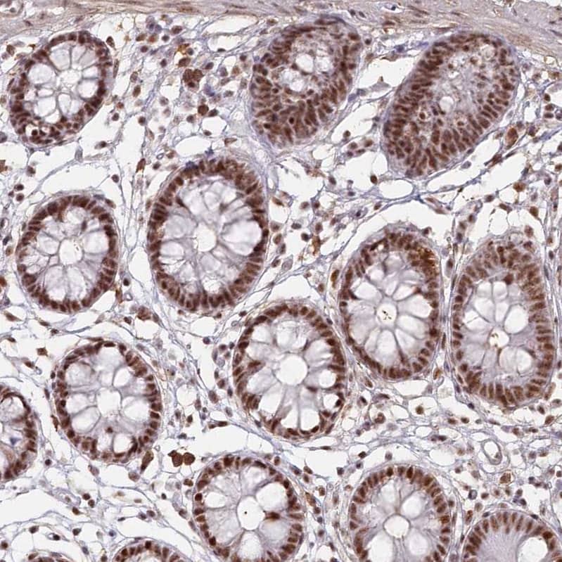 Immunohistochemistry-Paraffin DDX46 Antibody - BSA Free