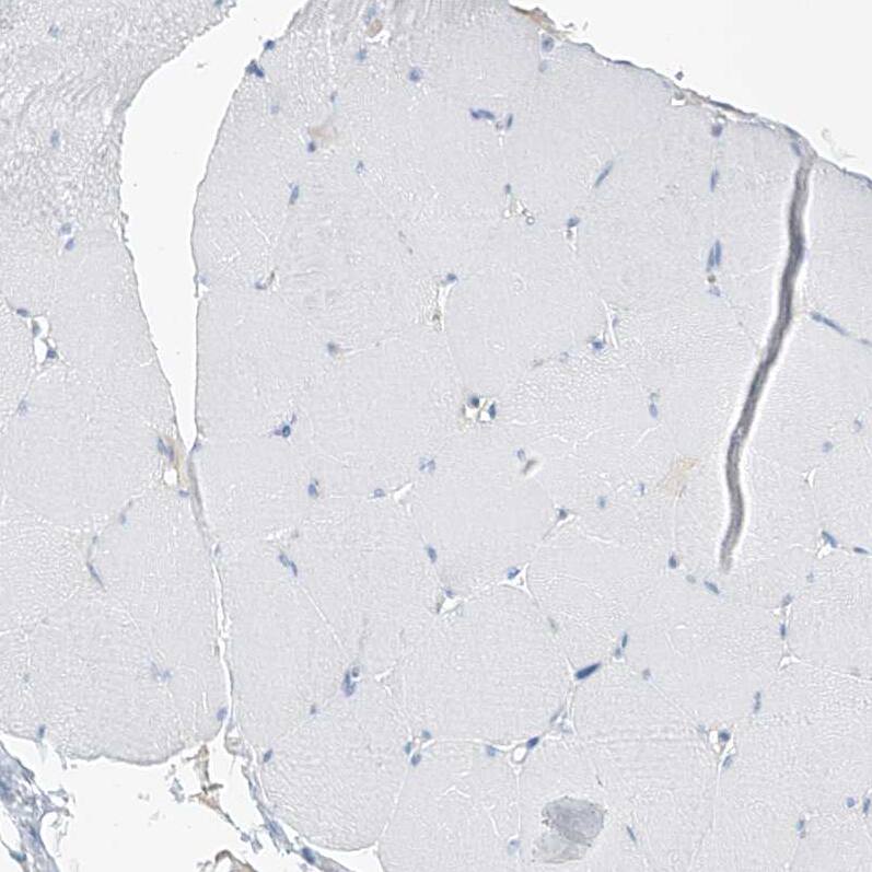 Staining of human skeletal muscle shows no positivity in myocytes as expected.
