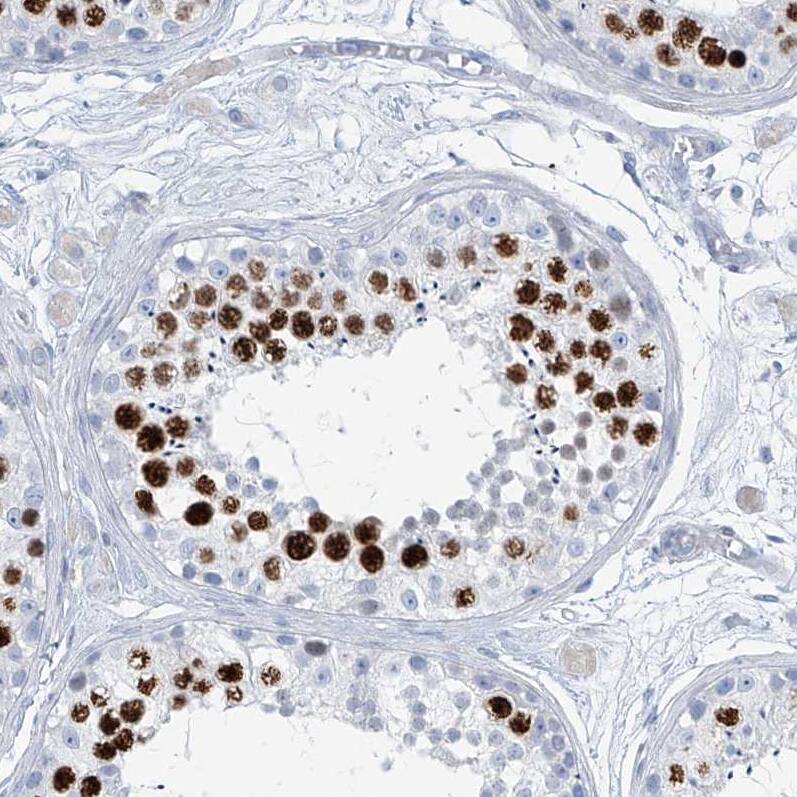 Staining of human testis shows strong nuclear positivity in cells in seminiferous ducts.