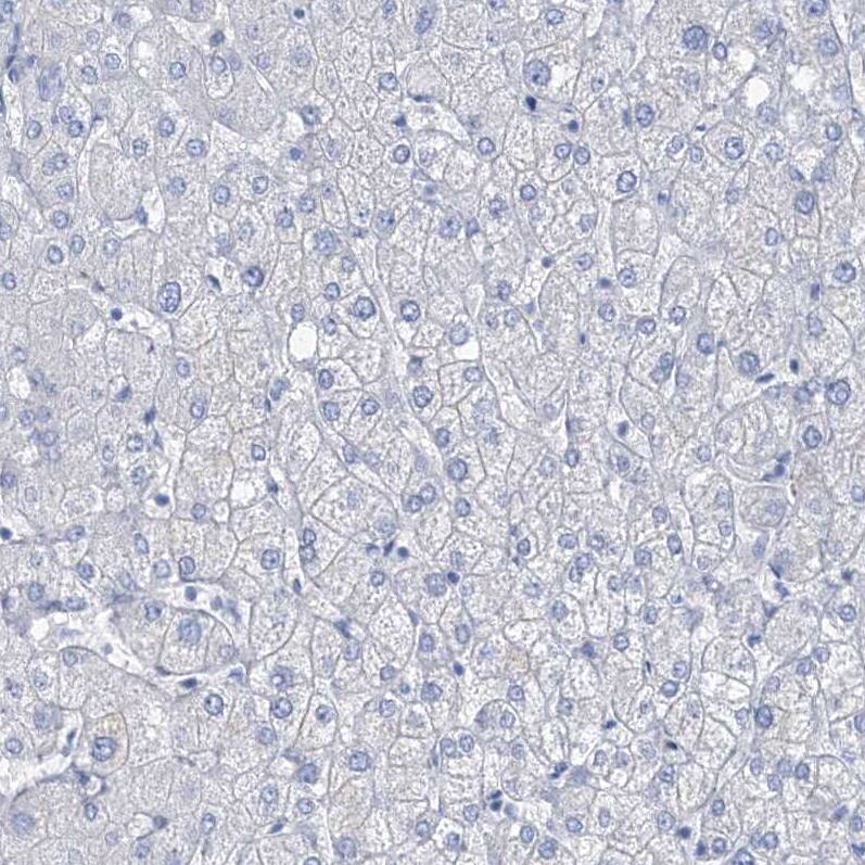 Staining of human liver shows no positivity in hepatocytes as expected.