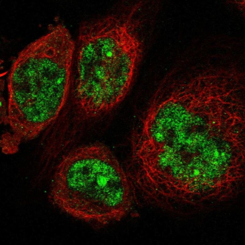 Staining of human cell line A-431 shows localization to nucleoplasm & nuclear bodies.