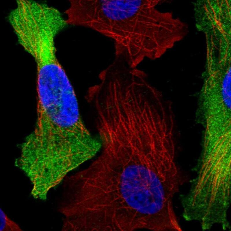 Staining of human cell line U-251 MG shows localization to plasma membrane & cytosol.