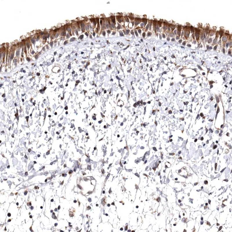 Immunohistochemistry-Paraffin FAM91A1 Antibody - BSA Free