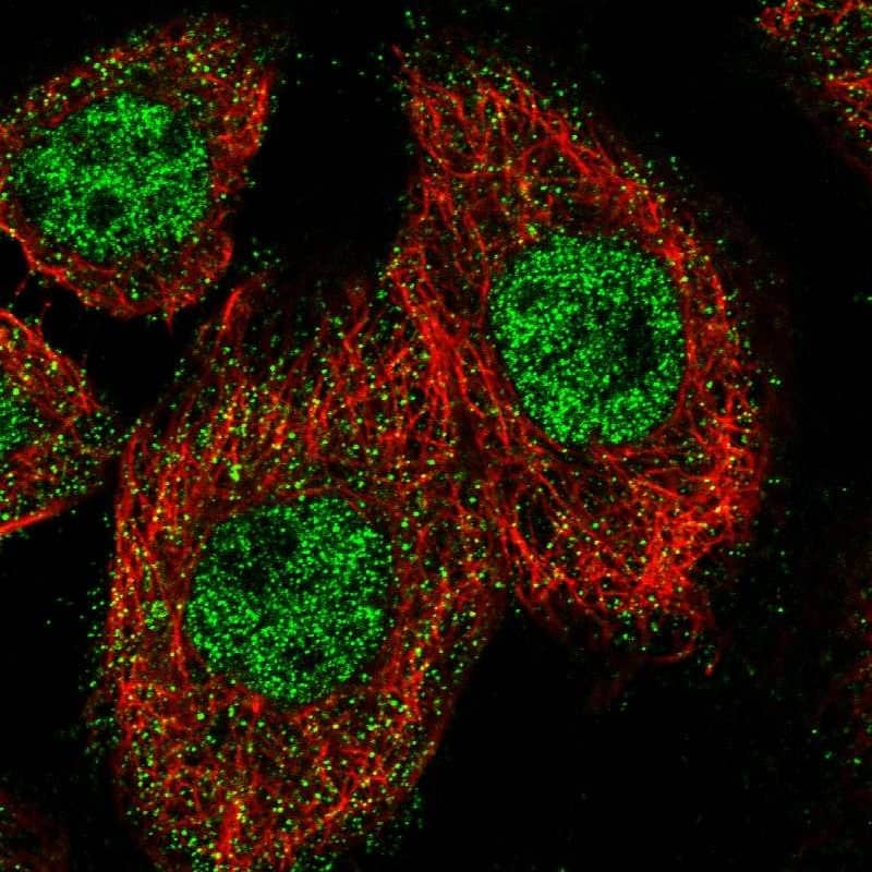 Immunocytochemistry/ Immunofluorescence ZNF449 Antibody - BSA Free
