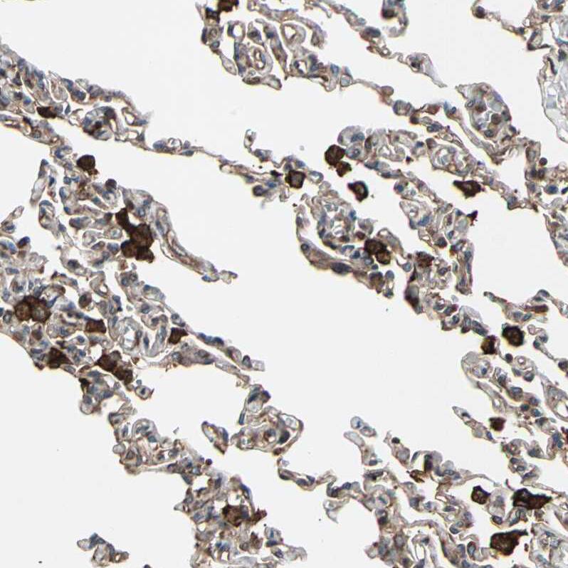 Immunohistochemistry-Paraffin AGBL2 Antibody - BSA Free