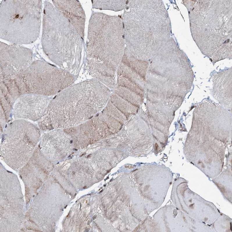 Staining of human skeletal muscle shows weak cytoplasmic positivity in myocytes.