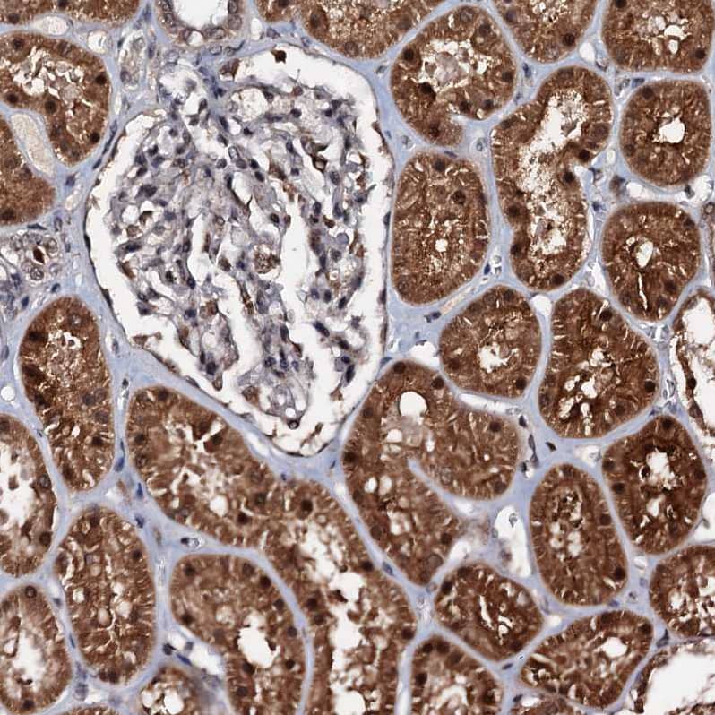 Staining of human kidney shows strong cytoplasmic positivity in cells in tubules.