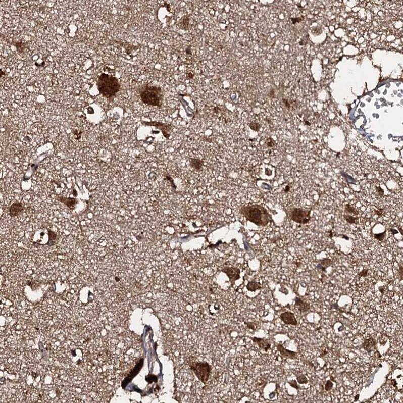 Staining of human cerebral cortex shows strong cytoplasmic positivity in neurons.