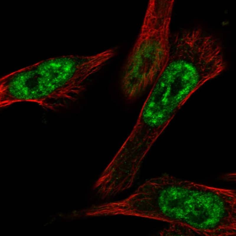 Immunocytochemistry/ Immunofluorescence CBLL1 Antibody - BSA Free