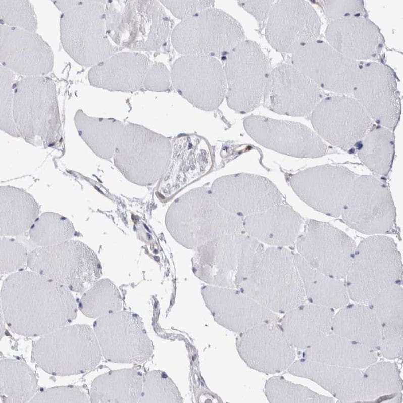 Staining of human skeletal muscle shows no positivity in striated muscle fibers as expected.