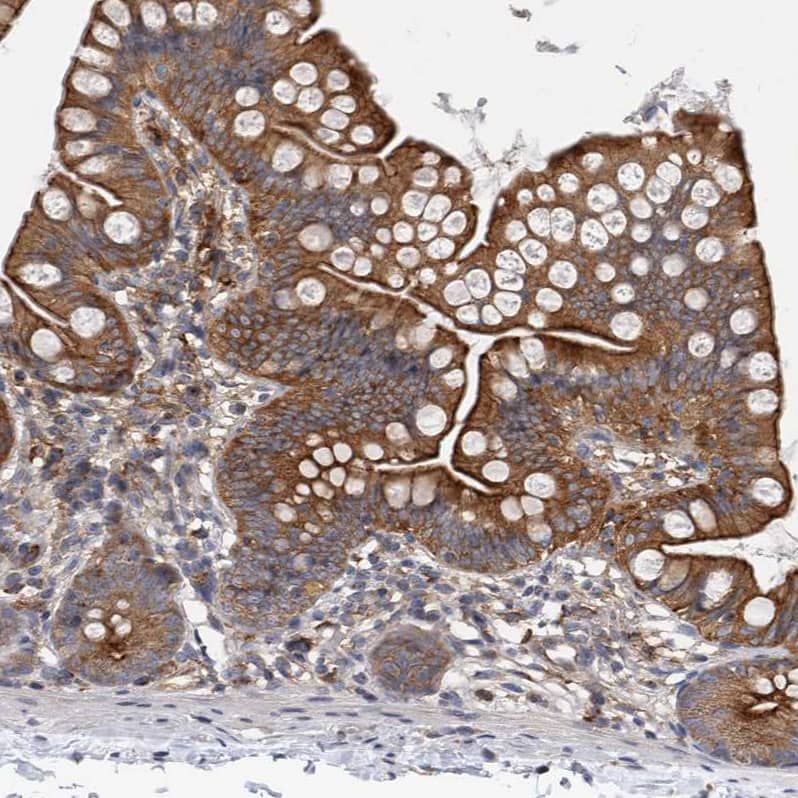 Staining of human small intestine shows moderate cytoplasmic and membranous positivity in glandular cells.