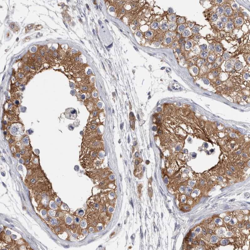 Staining of human testis shows moderate cytoplasmic positivity in cells in seminiferous ducts.