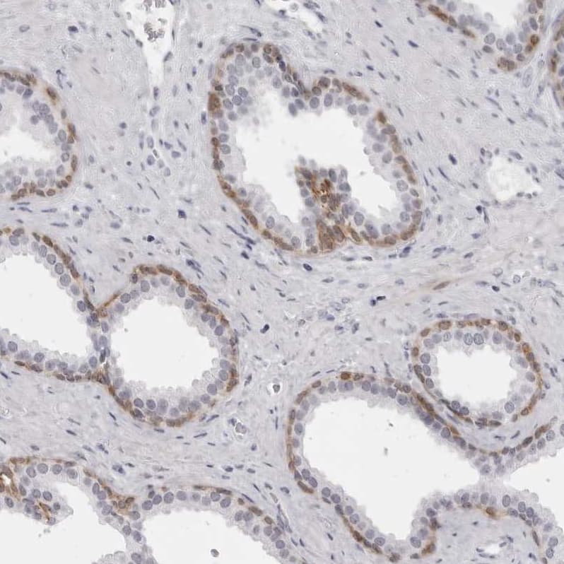 Staining of human prostate shows strong cytoplasmic positivity in basal cells.