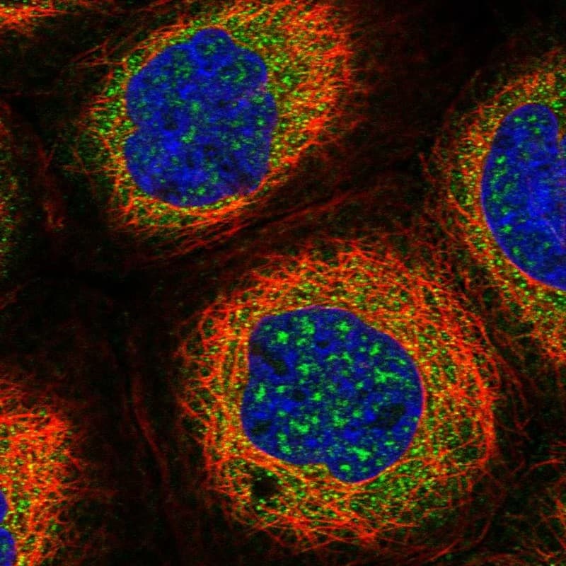 Staining of human cell line A-431 shows localization to nuclear speckles & cytosol.