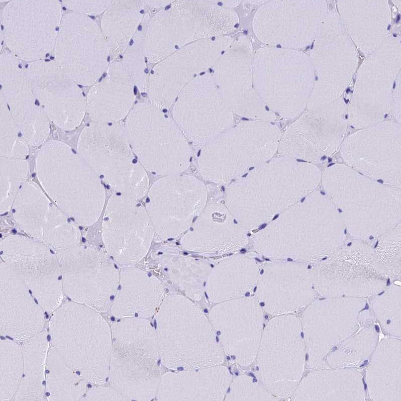 Staining of human skeletal muscle shows no positivity in myocytes as expected.