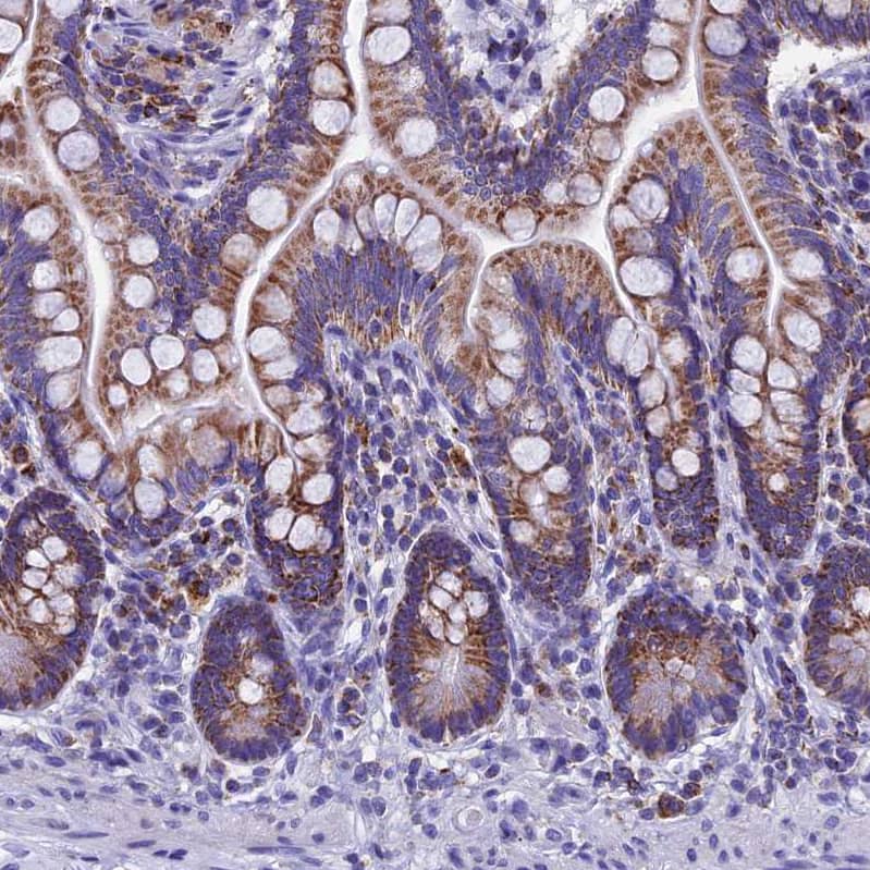 Staining of small intestine shows strong granular cytoplasmic positivity in glandular cells.