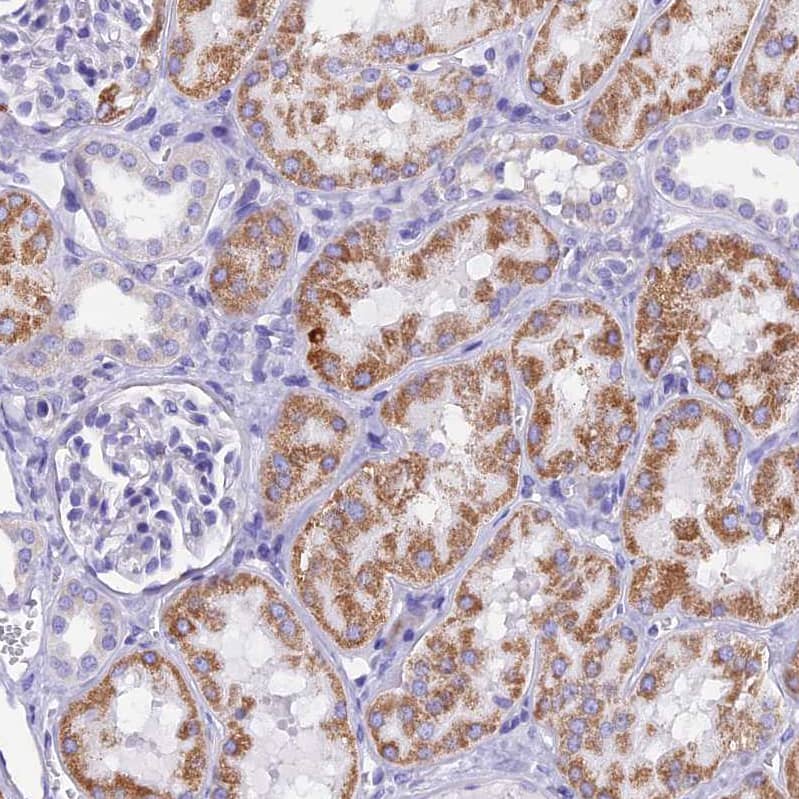 Staining of human kidney shows moderate granular cytoplasmic positivity in cells in tubules.