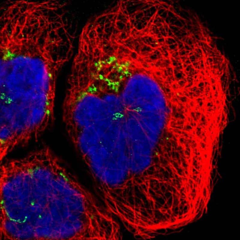 Staining of human cell line A-431 shows localization to the Golgi apparatus.