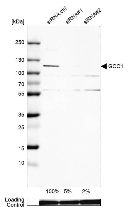 <b>Genetic Strategies Validation. </b>Analysis in U-138MG cells) transfected with control siRNA, target specific siRNA probe #1 and #2, using Anti-GCC1 antibody. Remaining relative intensity is presented. Loading control: Anti-GAPDH.