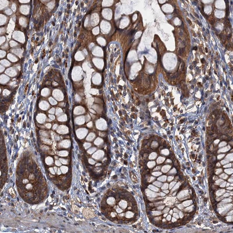 Staining of human rectum shows strong cytoplasmic positivity in glandular cells.