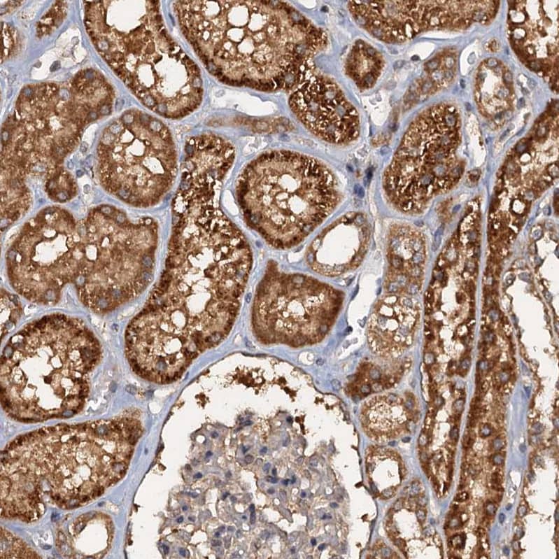 Staining of human kidney shows strong cytoplasmic positivity in cells in tubules.