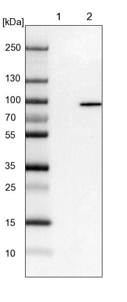 Lane 1: NIH-3T3 cell lysate (Mouse embryonic fibroblast cells))Lane 2: NBT-II cell lysate (Rat Wistar bladder tumour cells))