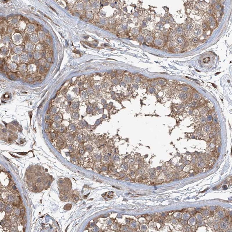 Immunohistochemistry-Paraffin AGBL5 Antibody - BSA Free