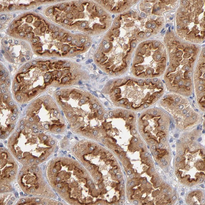 Staining of human kidney shows strong cytoplasmic positivity in cells in tubules.