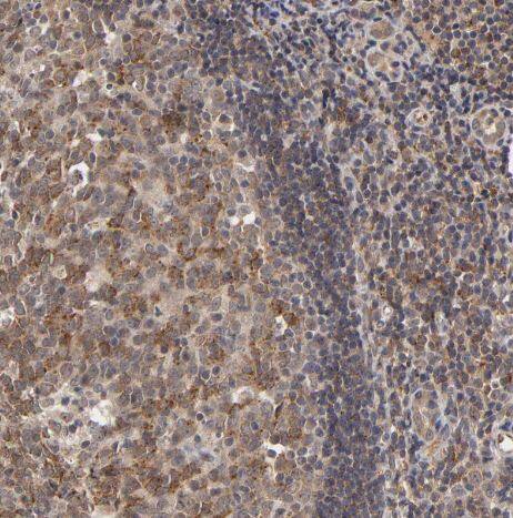 Immunohistochemistry-Paraffin ASB8 Antibody - BSA Free