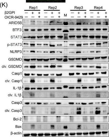 The activation of ARID5B/LINC01128/BTF3/STAT3 signalling in mice with antiphospholipid syndrome (APS). (A) Workflow of beta2‐glycoprotein I ( beta 2GPI) intraperitoneal injection and OICR‐9429 exposure,  beta 2GPI was injected once a week for 3 weeks to generate mice with vascular APS in vivo (number of mice in each group = 5). (B) Anti‐ beta 2GPI levels, (C) activated partial thromboplastin time (APTT) and (D) platelet count (PLT) were detected in the negative control (NC),  beta 2GPI and OICR‐9429+ beta 2GPI groups. (E) The blood velocity of the ascending aorta was tested using Doppler ultrasound in the three groups of mice. (F) The thrombus size of the carotid artery was tested by haematoxylin–eosin (HE) staining in the three groups of mice; original magnification, 100×. (G–I) ELISA displaying the serum levels of interleukin (IL)‐18, IL‐1 beta  and tissue factor (TF), respectively. (J) Real‐time quantitative PCR (RT‐qPCR) to detect the expression of LINC01128 in the three groups of mice. (K) Western blotting indicated the expression of ARID5B, BTF3 and p‐STAT3/STAT3, the activity of pyroptosis and apoptosis pathways in the three groups of mice. (L) Schematic diagram illustrating the potential mechanism of ARID5B‐mediated LINC01128 in p‐STAT3‐induced pyroptosis and apoptosis activation in APS. Data information: error bars represent the mean +/- SD of at least three independent experiments. M, marker; ns, not significant; **p < .01; ***p < .001. Image collected and cropped by CiteAb from the following open publication (//pubmed.ncbi.nlm.nih.gov/38224186), licensed under a CC-BY license. Not internally tested by Novus Biologicals.