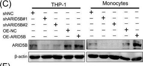 ARID5B transcriptionally activated LINC01128 expression. (A) Schematic representation of eight target long non‐coding RNAs (lncRNAs) of ARID5B in anti‐ARID5B Cleavage Under Targets and Tagmentation (CUT&Tag) in THP‐1 cells. (B) The two binding sites of ARID5B at the LINC01128 promoter were predicted using //bioinfo.life.hust.edu.cn/hTFtarget#!/website. (C) Western blotting and (D) real‐time quantitative PCR (RT‐qPCR) analysis of ARID5B expression after transfection with two shRNAs (shARID5B#1 and shARID5B#2) or overexpression lentivirus in THP‐1 cells and monocytes. (E) RT‐qPCR analysis of LINC01128 expression after transfection with the above shRNAs or overexpression lentivirus. (F) RT‐qPCR analysis of LINC01128 expression after treatment with  beta 2GPI/anti‐ beta 2GPI immune complex (IC) in shARID5B‐THP‐1 cells. (G) Integrative Genomics Viewer (IGV) and quantitative PCR (qPCR) representation of anti‐ARID5B CUT&Tag at the LINC01128 promoter in the scrambled negative control (shNC)‐ and shARID5B‐THP‐1 cells. (H) Schematic representation of the mutated sequences of potential ARID5B‐binding sites on the LINC01128 promoter; luciferase activity after transfection with a reporter containing wild‐type (WT‐LINC01128) or mutant LINC01128 (Mut‐LINC01128) promoter constructs in 293T cells. (I) RNA fluorescence in situ hybridisation (FISH) assay showing the subcellular localisation of LINC01128 in THP‐1 cells; U6 was used as a nuclear localisation control; green, LINC01128; red, U6; blue, DAPI. (J) Nuclear fractionation and RT‐qPCR analysis of LINC01128 expression in the nucleus and cytoplasm. Data information: error bars represent the mean +/- SD of at least three independent experiments. ns, not significant; *p < .05; **p < .01; ***p < .001.  beta 2GPI, beta2‐glycoprotein I. Image collected and cropped by CiteAb from the following open publication (//pubmed.ncbi.nlm.nih.gov/38224186), licensed under a CC-BY license. Not internally tested by Novus Biologicals.