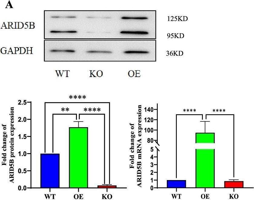 ARID5B suppresses the expression of CCR2, MCP-1, and TNF-alpha  and the migration and adhesion of THP-1 cells. A The protein and mRNA expression of ARID5B in wild-type, ARID5B-overexpressing and ARID5B-knockout THP-1 cells. B Relative mRNA expression levels of CCR2, MCP-1, and TNF-alpha  in THP-1 cells. C The migration capacity of THP-1 cells was assessed by Transwell migration assays with an inverted microscope (magnification × 100). D The adhesion of THP-1 cells to HUVECs was assessed using a fluorescence microscope (magnification × 100). All plotted values are the mean +/- SE values of at least three independent experiments. WT, wild type; OE, overexpression; KO, knockout. *p < 0.05, **p < 0.01, ***p < 0.001, ****p < 0.0001 Image collected and cropped by CiteAb from the following open publication (//pubmed.ncbi.nlm.nih.gov/35227297), licensed under a CC-BY license. Not internally tested by Novus Biologicals.
