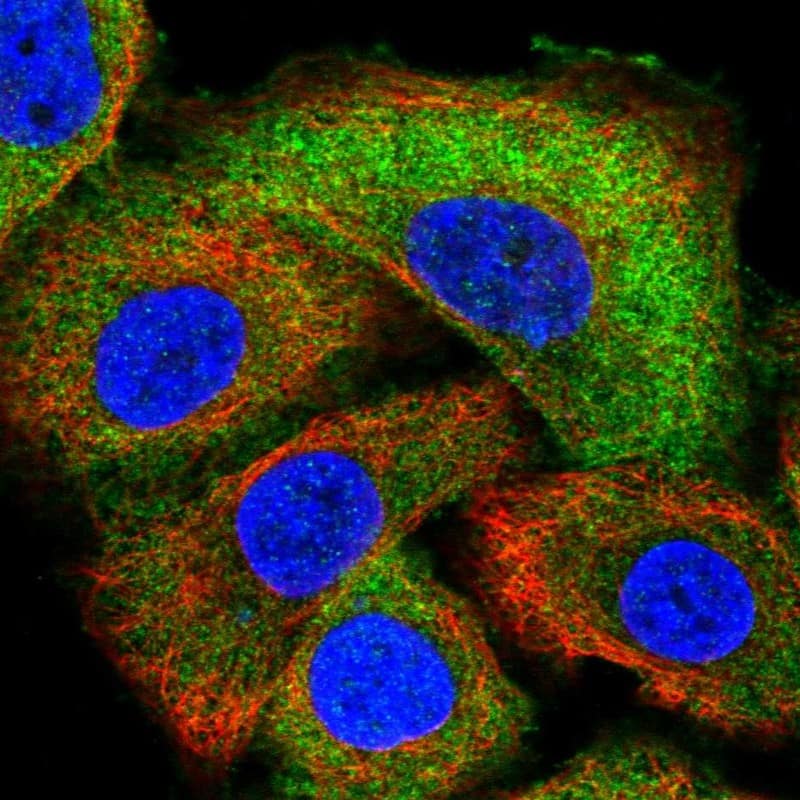 Staining of human cell line A549 shows localization to cytosol.