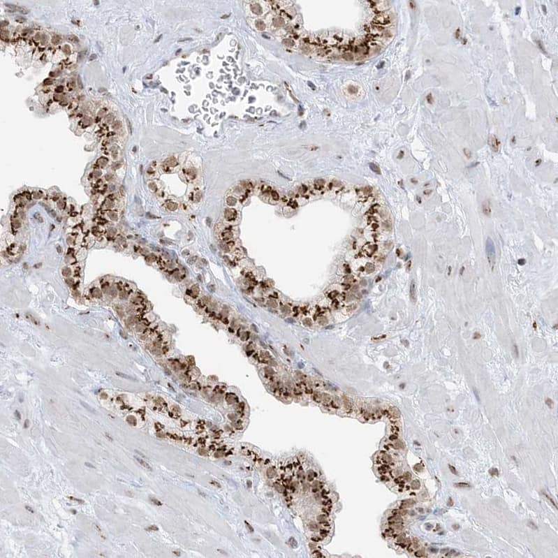 Staining of human prostate shows strong positivity in Golgi apparatus in glandular cells.