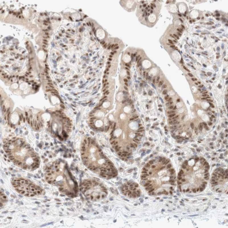 Staining of human colon shows moderate nuclear positivity in glandular cells).
