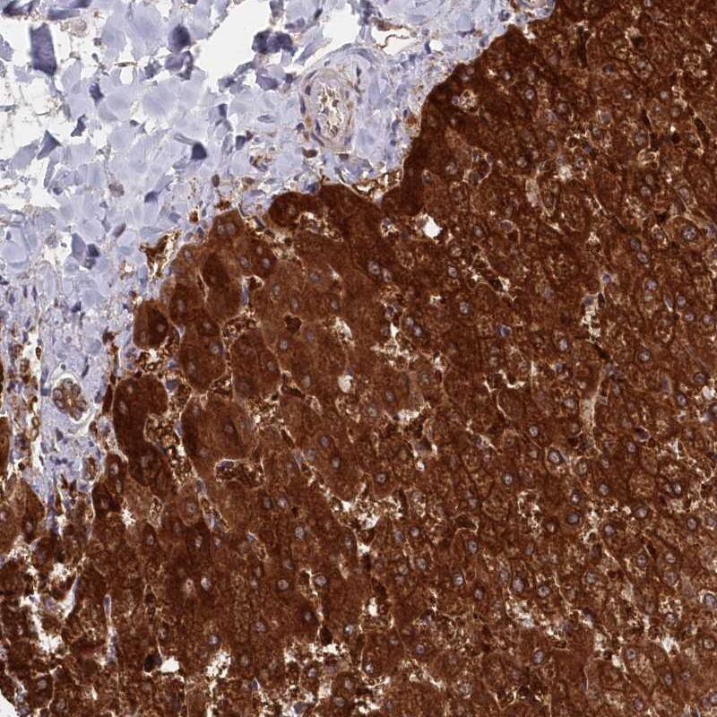 Staining of human liver shows strong cytoplasmic positivity in hepatocytes.