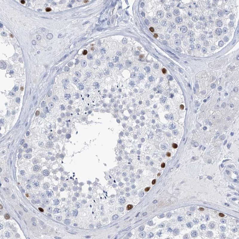 Staining of human testis shows strong nuclear positivity in cells in seminiferous ducts.
