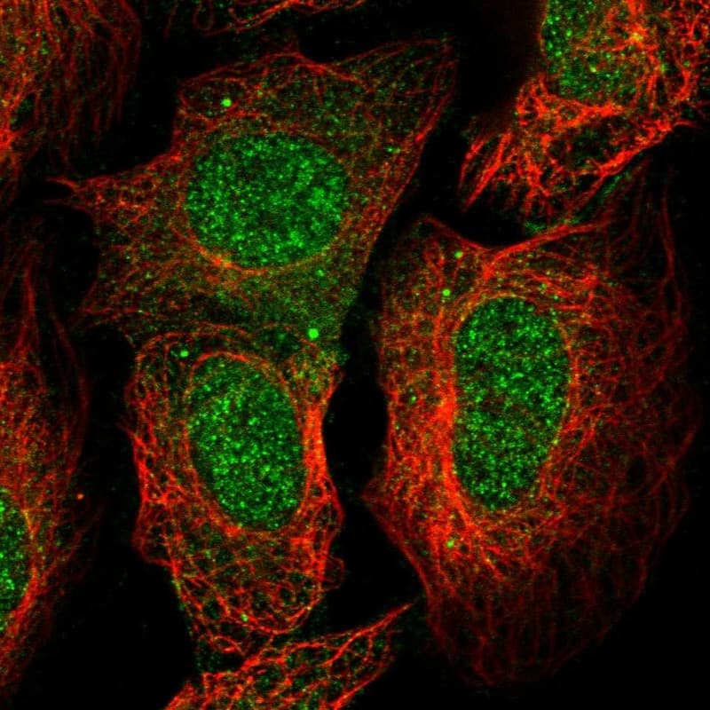 Staining of human cell line U-2 OS shows localization to nucleoplasm & nuclear membrane.
