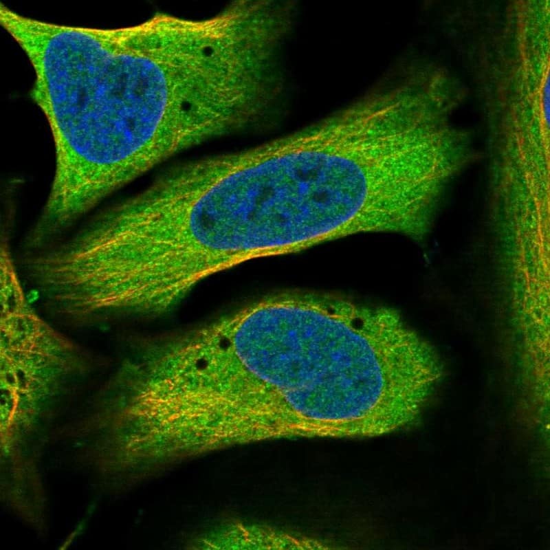 Immunocytochemistry/ Immunofluorescence PIGX Antibody - BSA Free