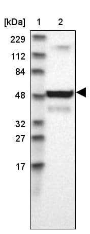 Lane 1: Marker [kDa] 229, 112, 84, 48, 32, 27, 17Lane 2: Human cell line RT-4