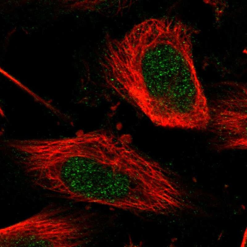 Staining of human cell line U-251 MG shows localization to nucleus.