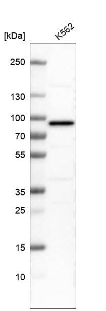 Analysis in human cell line K562.