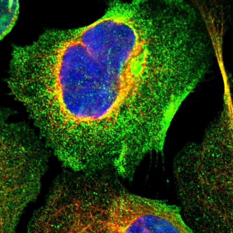 Immunocytochemistry/ Immunofluorescence LAX1 Antibody - BSA Free