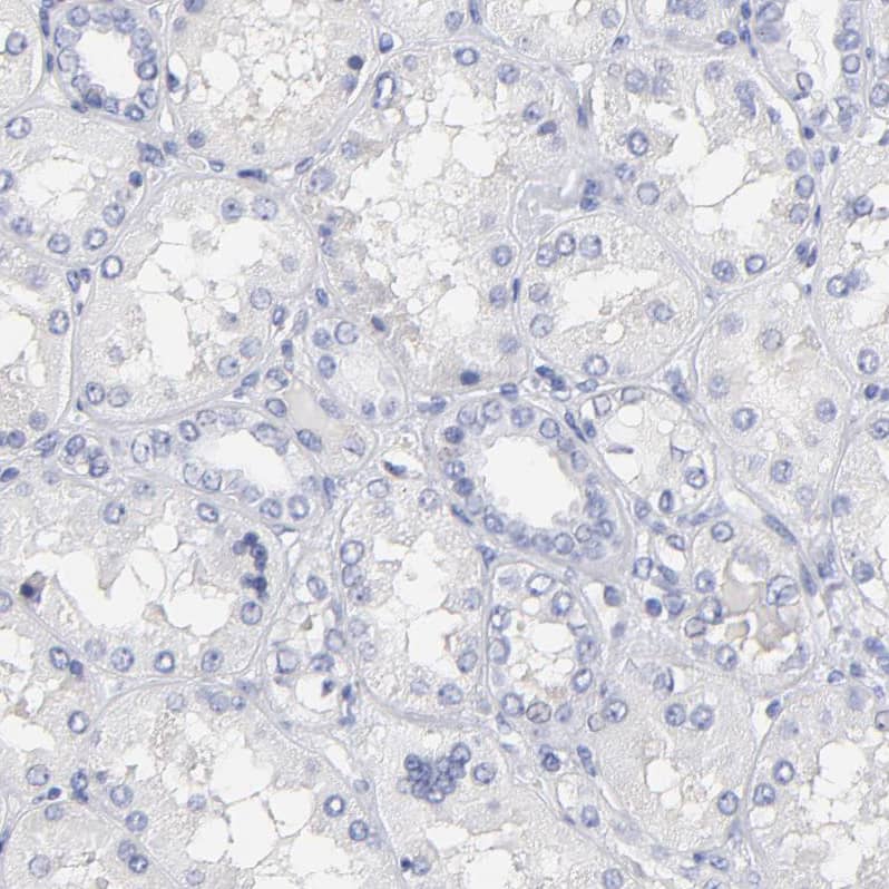 Immunohistochemistry-Paraffin LAX1 Antibody - BSA Free