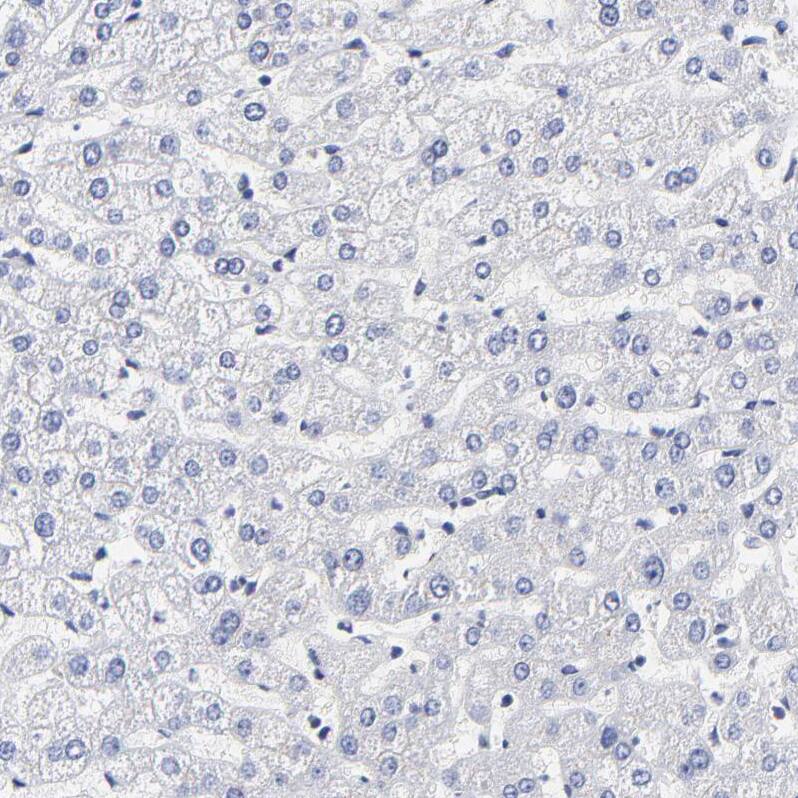 Immunohistochemistry-Paraffin LAX1 Antibody - BSA Free