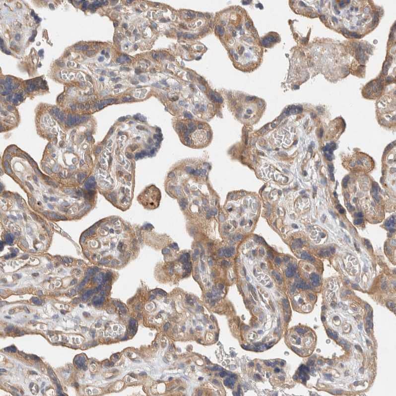Staining of human placenta shows  moderate cytoplasmic positivity in trophoblastic cells.