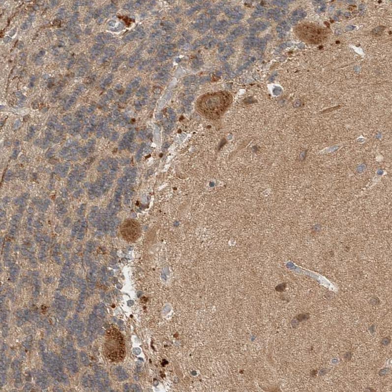 Staining of human cerebellum shows strong cytoplasmic positivity in Purkinje cells.